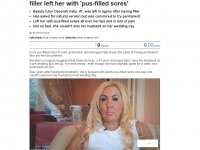 2014-03-19 Botched up Bodies_ Brides' Deborah in agony after having permanent filler _ Mail Online_Page_1