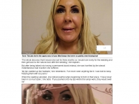 2014-03-19 Botched up Bodies_ Brides' Deborah in agony after having permanent filler _ Mail Online_Page_2